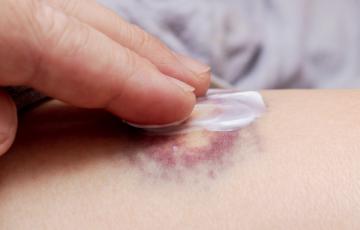 Les maladies de peau chez la personne âgée